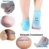 Moisturizing Gel Heel (Half) Socks | Swelling & Pain Relief |Gel Lining Infused with Vitamins Exfoliating| Dry Hard Cracked Heel Repair Pad| - Image 3